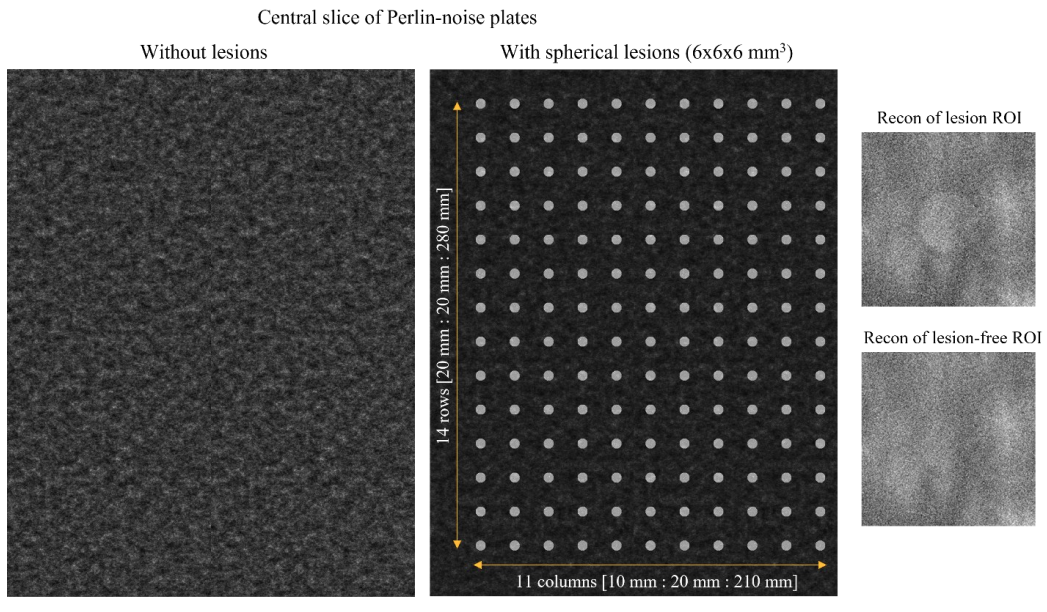 Spatial dependency of lesion detectability in digital breast tomosynthesis