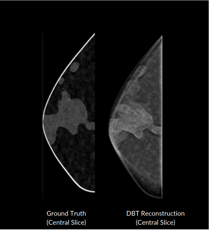 Novel Perlin-based phantoms using 3D models of compressed breast shapes and fractal noise